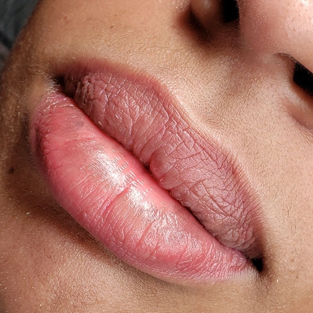 Everything You Need To Know About Lip Neutralisation.